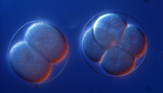 Picture of cleaving sea urchin eggs